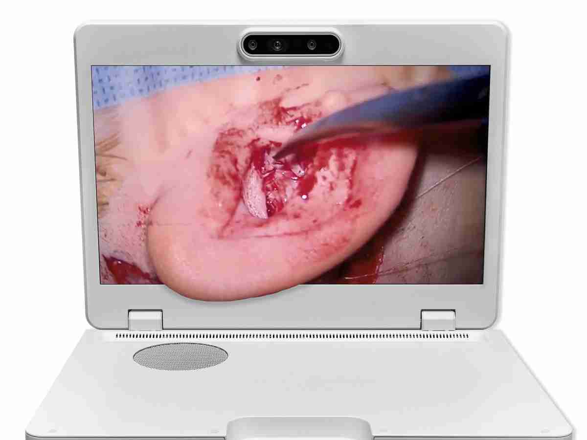 达擎之＂Heads-up 3D显微手术显示系统＂，，，整合4K裸眼3D显示及眼球追踪系统，，具备快速追踪人眼移动位置功能，，，，减轻医师长时间维持固定姿势的负担，，让医师能有更宽广清晰的3D立体视野及更舒适的姿势来执行手术。。。。